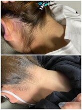 リガート(REGART)/レディース 襟足