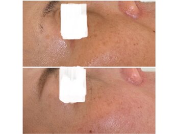 アリュール(Allule)/