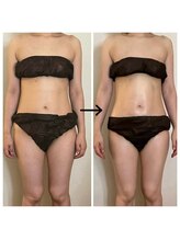 リオラ ビューティー(Liora beauty)/《before/after》