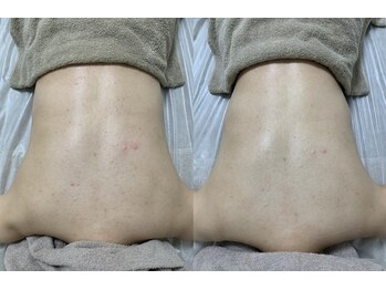 ニコ(25)/オプションゾンビ