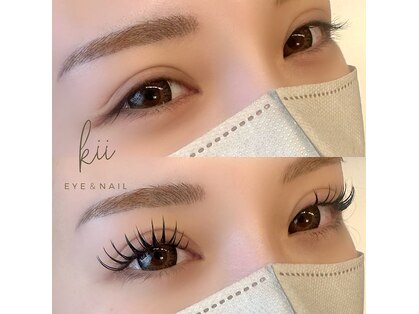 キー(kii)の写真