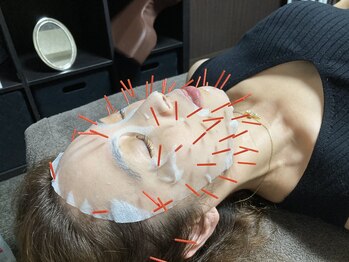 アキュモ整体ラボ/若肌によみがえる