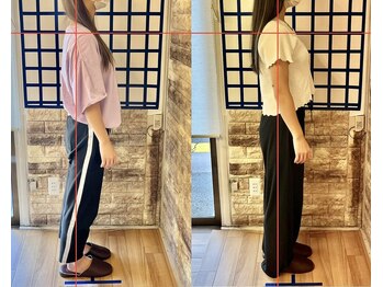 整体院リノベボディ(リノベBODY)/悩み：姿勢を良くしたい［20代］
