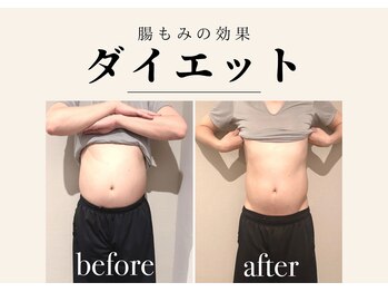 サンク(Cinq)/腸もみの効果◆ダイエット/痩身