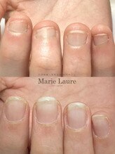 マリーロール 梅田店(Marie Laure)/自爪育成/深爪矯正/ネイルケア