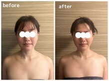 ライズサロン(RiseSALON)/肩こり首こり小顔