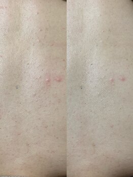 ニコ(25)/オプションゾンビ