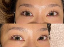 アイラウンジ ミリ(eyelounge mm)