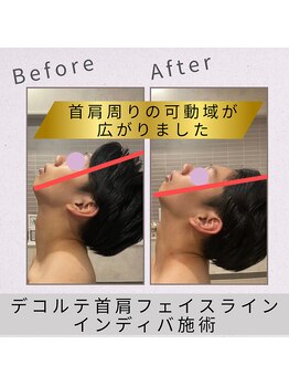 インディバ サロン ド ルル(INDIBA salon de Loulou)/スマホ首ストレーネックにも◎！