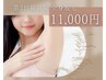 【全身脱毛】7/13(日)限定　全身脱毛(顔・VIO込み)　都度払い制11,000円