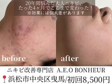 アエオボンヌール(A.E.O BONHEUR)