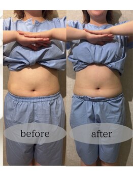 マホロバ セカンド(mahoroba 2nd)/くびれスッキリ腸マッサージ