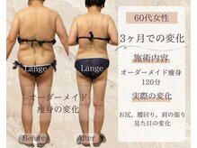 サロン ド ボーテ ラーンジュ 岐阜店(salon de beaut'e L'ange)/ハイパ-ナイフEX2ダイエット痩身