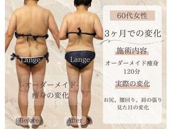 サロン ド ボーテ ラーンジュ 岐阜店(salon de beaut'e L'ange)/ハイパ-ナイフEX2ダイエット痩身