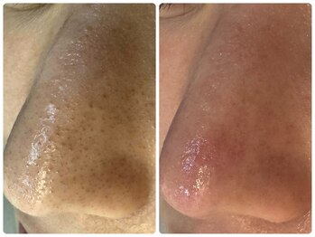 サイセイ(SAISEI)/