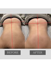 ツカ(TSUKA)/腰の歪みを整えて腰痛ラクに！