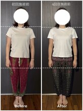 ベルサンテ イオ(belle sante'io)/整体＋頭蓋調整90分コース　