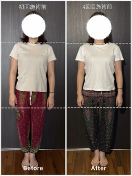 ベルサンテ イオ(belle sante'io)/整体＋頭蓋調整90分コース　