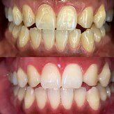 リムーブラボ 藤岡店(Remove Lab.)