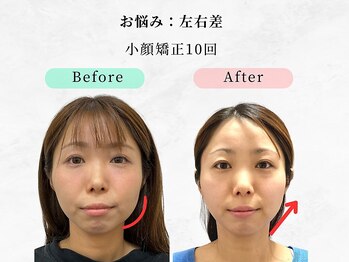 ウェリナ 一宮院/小顔矯正/骨盤矯正/痩身整体