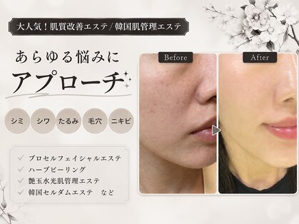 リベルテ(Liberte)の写真