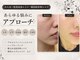 リベルテ(Liberte)の写真
