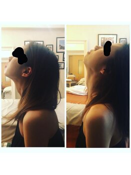 ボーテペズナズ(Beaute'Pezenas)/人気の絶えないベッドセラピー