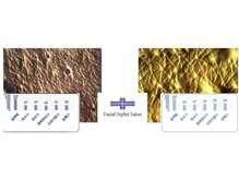 フェイシャルスタイリストサロン 四谷店/ケア例（55）