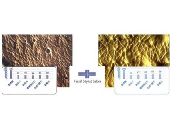 フェイシャルスタイリストサロン 四谷店/ケア例(55)