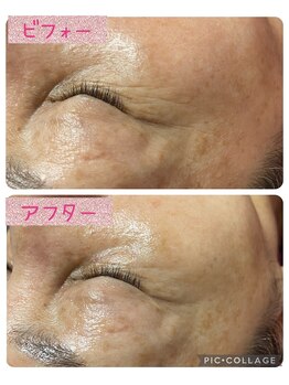 ビューティーサロン キャンディ 海老名(Candy)/