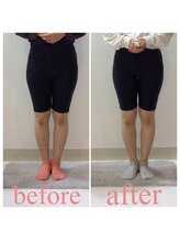 スタイルラボ高松/骨盤矯正の効果♪