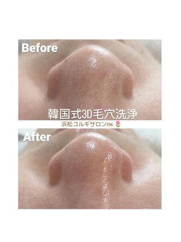 ミードット(me.)/最新の韓国式3D毛穴洗浄☆