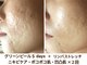 ノットノット 自由が丘(Not Knot)の写真