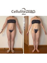 メリッサ(Melissa)/整えてキレイに