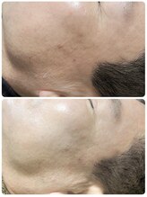 ル クラージュ(Le courage)/光フォト(50代男性)