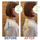 四条大宮アシスト鍼灸整骨院