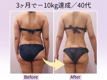 ナレル(narrel)の写真