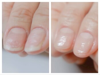 アヤネイル(Aya nail)/自爪育成ケア