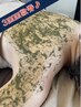 【ザラつきオフ魅せる背中★】早得回数券♪背中ハーブ3回分¥100,650→¥66,000