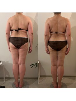 ラナ 京都西院店(Lana)/よもぎ蒸し＆リンパマッサージ