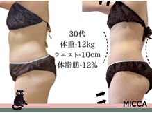 ヨサパーク ミッカ 学芸大学(YOSA PARK MiCCA.)/驚愕の結果パート３