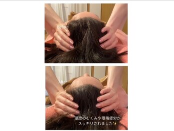 スターリィ スカイ(Starry☆Sky)/【ハイドロ/スキャルプ】