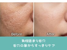 ココミエレ(COCO MIELE)/頬の毛穴ケア