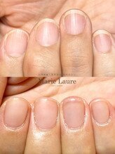 マリーロール 梅田店(Marie Laure)/自爪育成/深爪矯正/ネイルケア
