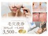 【お肌全体のザラつき/くすみが気になる方】毛穴洗浄〈全顔〉¥5500→¥4000