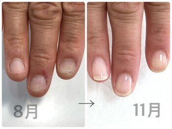 プライベートネイルサロン ルミアス(LUMIAS)