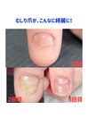 むしってしまったお爪