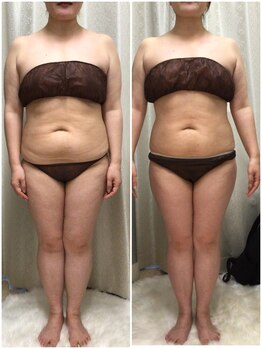 リンエステティック(凜ESTHETIC)/