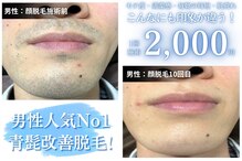 ダイヤモンド ビューティーラウンジ(DBL)