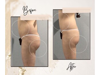 アイ アンド ネイルデイ 桂(EYE＆NAIL DAY)/キャビMAX